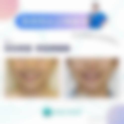 八、湖南长沙初生整形医院预约方式