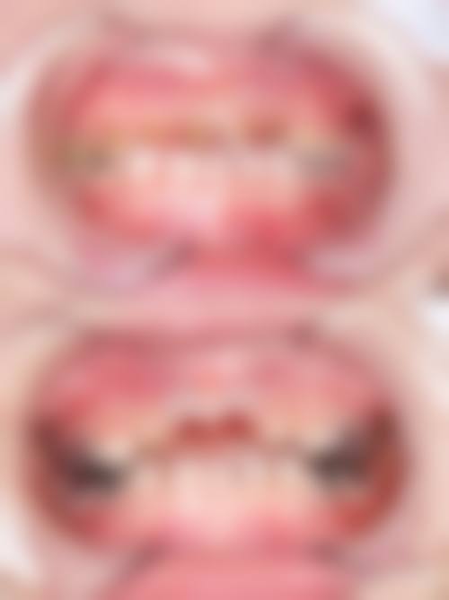 六、厦门思明汇丽整形价格表