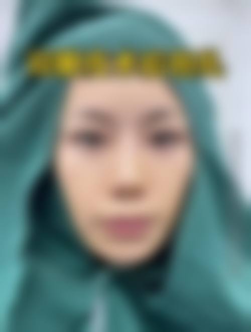 五、重庆夫碧韦弗整形医院价格表