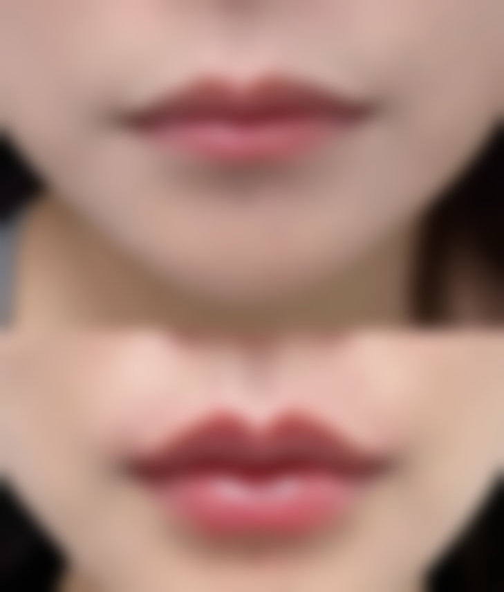 四、其他有助于修复的建议