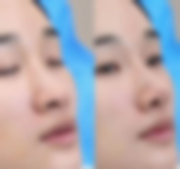 五、芜湖市第一人民医院(皮肤美容科)价格表