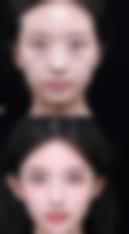 九、东莞圣之慧医疗美容门诊部真实的患者评价