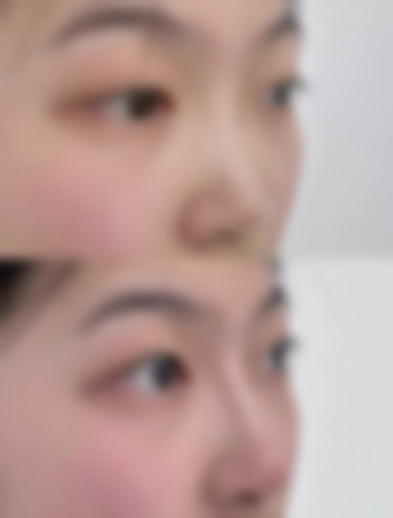 四、上海爱莫儿整形医疗美容门诊部特色项目