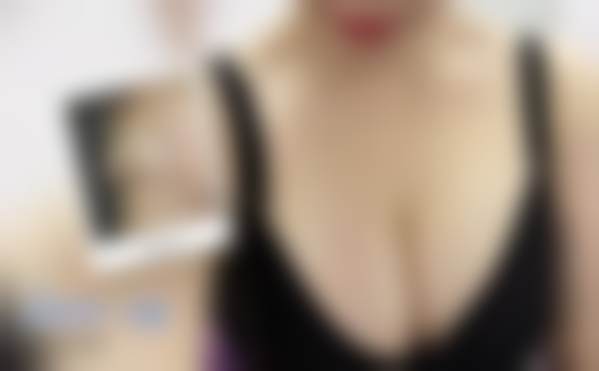 北京禾美嘉医疗美容门诊部贺天遥收费贵不贵？揭秘合理价格背后的优质服务