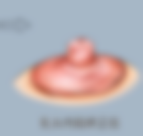 疤痕增生激光可以去掉吗？总结来说