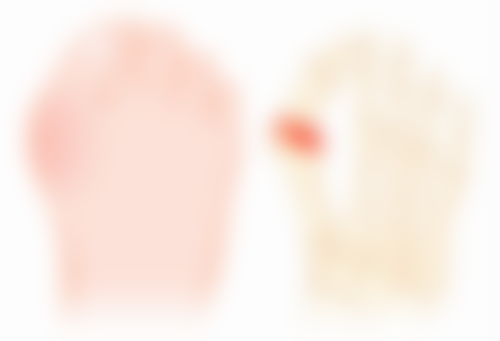 手术切除眼袋有后遗症吗？看图片了解常见反应、长期风险及应对办法 