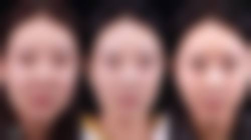 腹部吸脂大概多少？受多因素影响价格1 - 5 万元需综合评估 