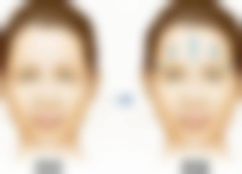 三、北京朗皓齿科诊疗项目有哪些?