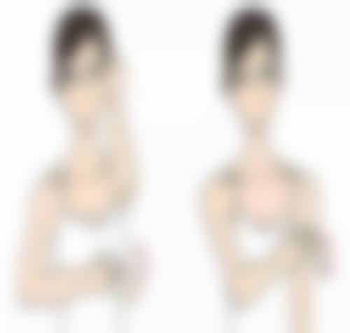 四、国内隆胸技术亮点