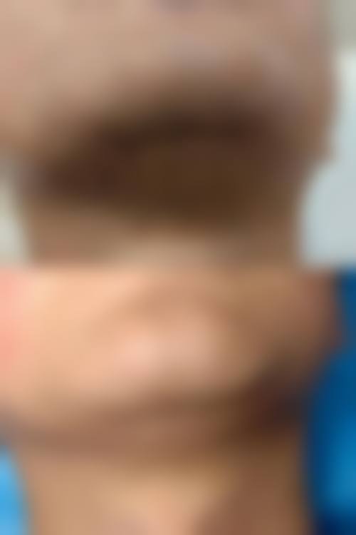 九、成都莱尹医疗美容整形医院真实的患者评价