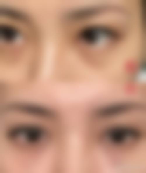 五、陆 军军 医 大学第二附属医院重庆新桥医院整形美容外科价格表