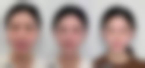 四、武汉西婵整形美容门诊部特色项目