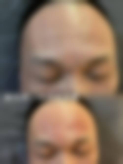 八、济南皮肤疮疡医院整形科真实的患者评价