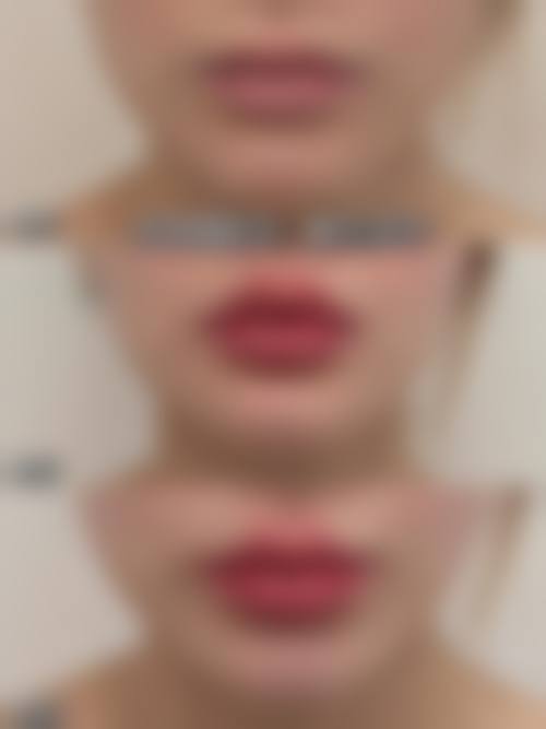 八、武汉克美娜整形医院真实的患者评价