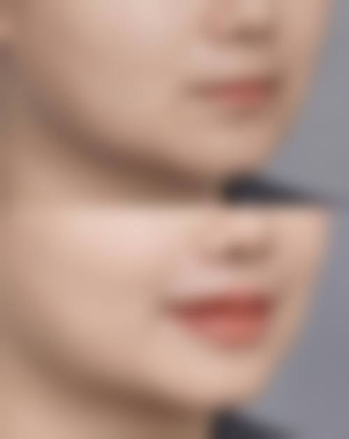 五、武汉克美娜整形医院价格表