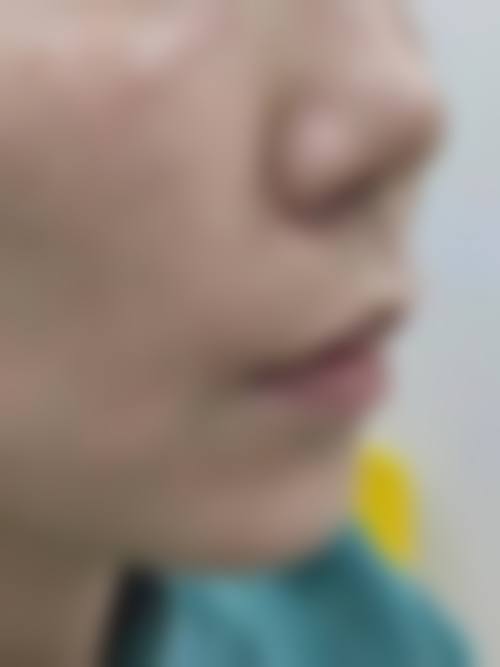 九、衡阳希美医疗美容门诊部真实的患者评价