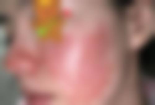 八、陆 军军 医 大学第二附属医院重庆新桥医院整形美容外科真实的患者评价