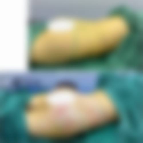 九、宜兴丽都医疗美容门诊部真实的患者评价