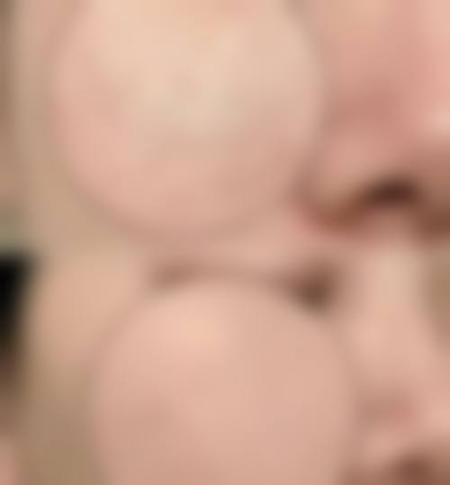 四、深圳春天医院整形美容科特色项目