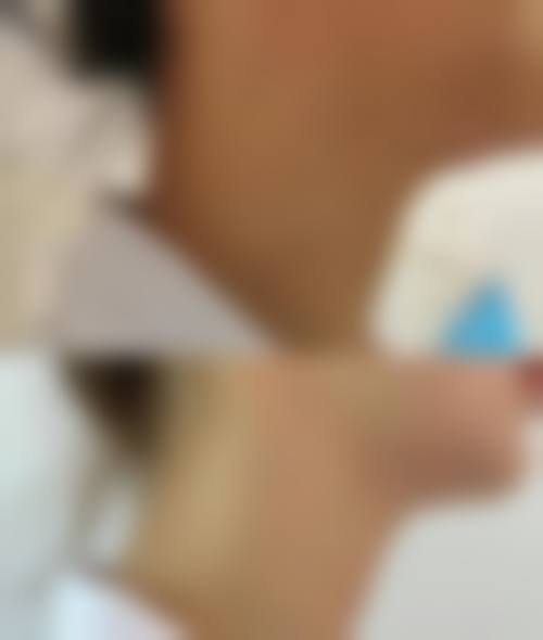 九、深圳清颜臻宜医疗真实的患者评价