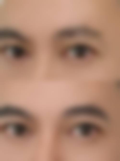 四、陆 军军 医 大学第二附属医院重庆新桥医院整形美容外科特色项目