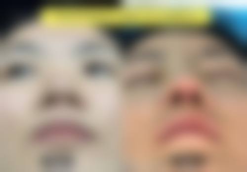 九、资中达瑞希整形医院真实的患者评价