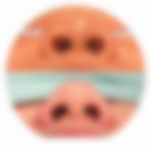 四、郑州美岚(赵灵卿)医疗美容特色项目