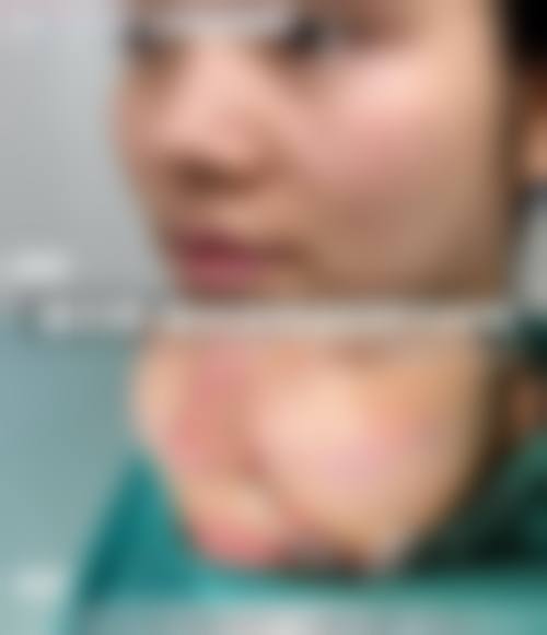 三、沈阳颜悦医疗美容中 心诊疗项目有哪些?