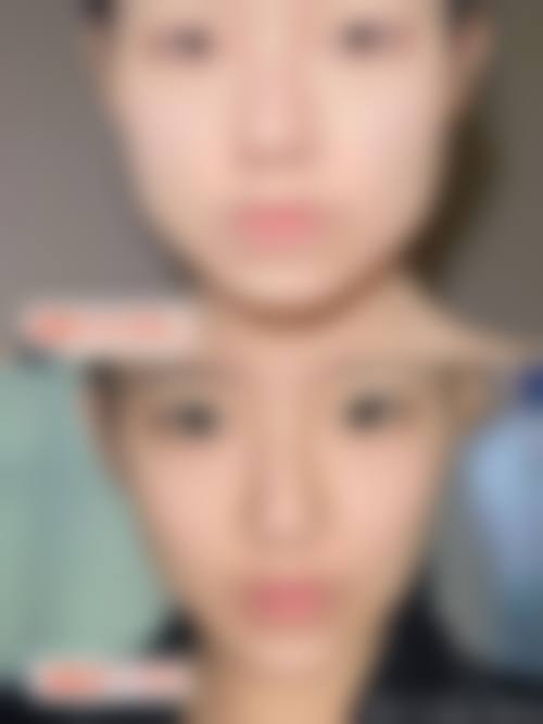 五、张义晨怎么预约？