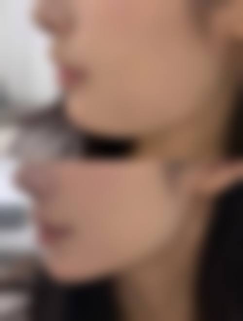 三、张义晨技术优势