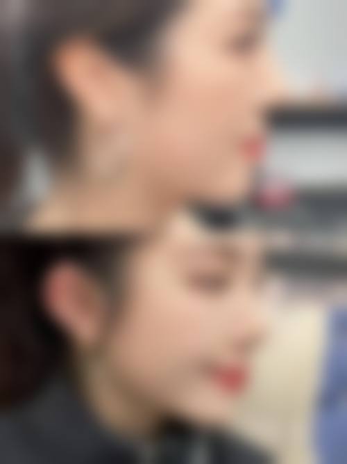 六、张义晨真实的患者评价