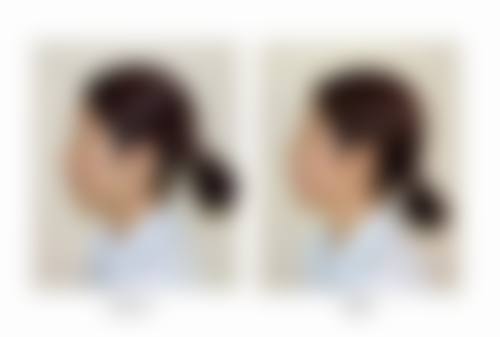 四、成都名府整形外科门诊部特色项目