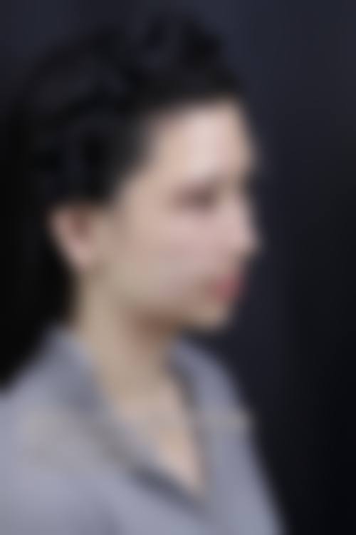 六、成都莱尹医疗美容整形医院价格表