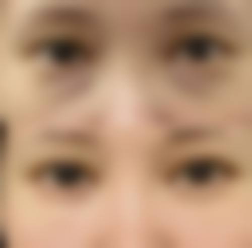 三、济南皮肤疮疡医院整形科诊疗项目有哪些？