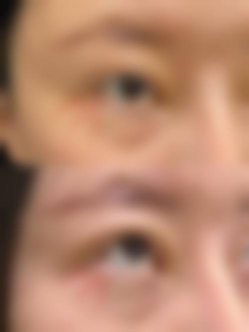 四、广州普罗菲医疗美容诊所特色项目