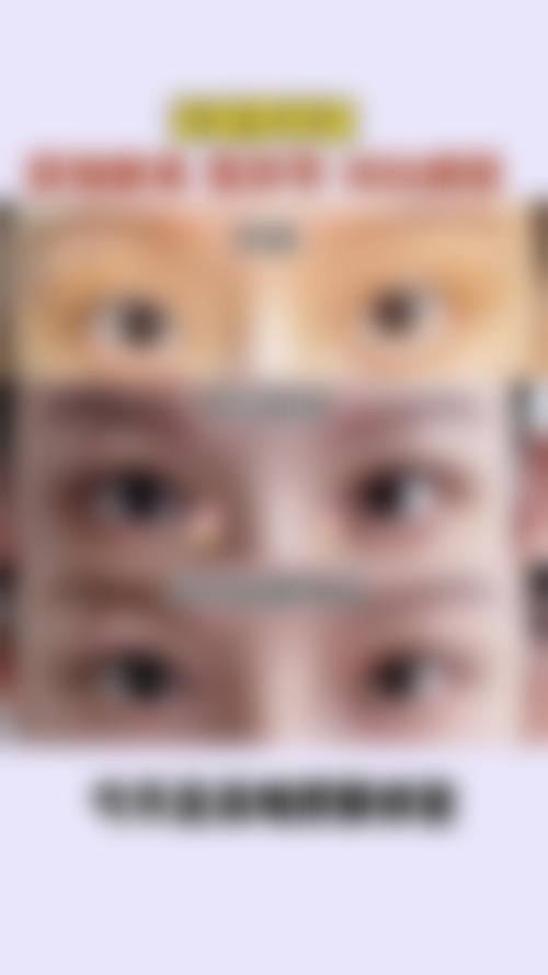 九、广州普罗菲医疗美容诊所真实的患者评价