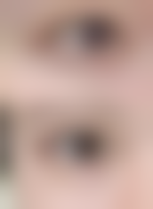 五、郑州美岚(赵灵卿)医疗美容医生介绍