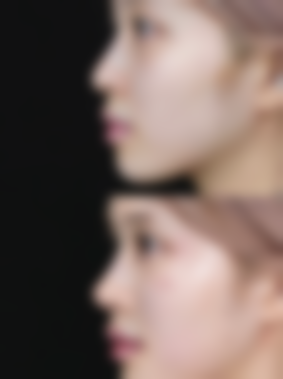 三、其他注意事项