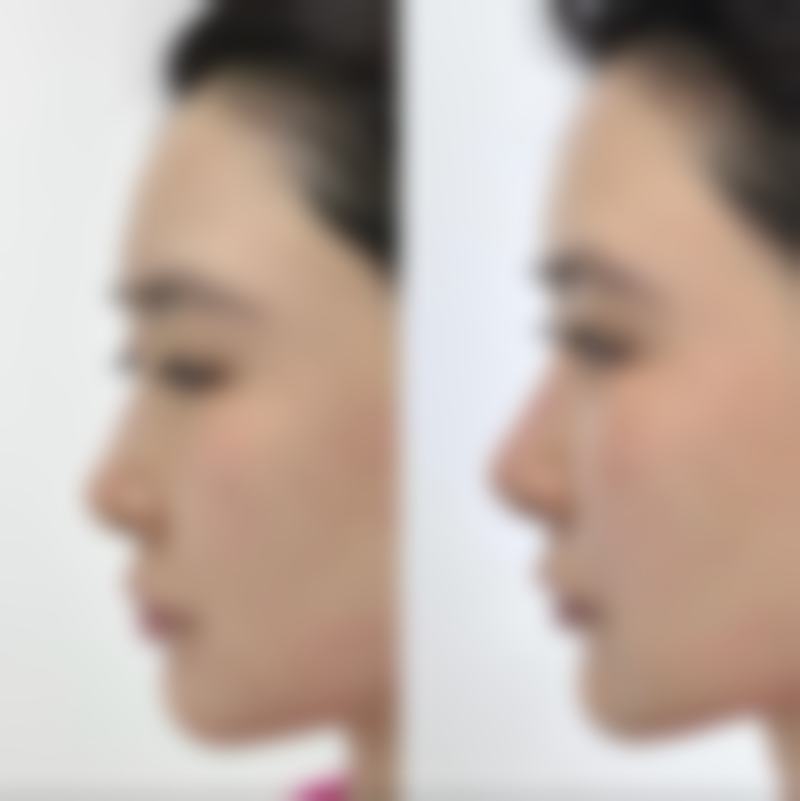 八、沈阳颜悦医疗美容中 心真实的患者评价