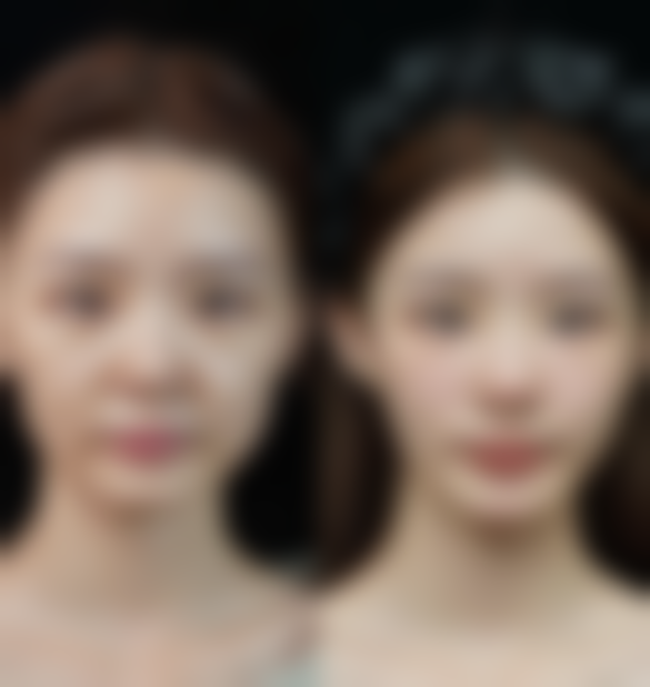 七、常见疑问解答