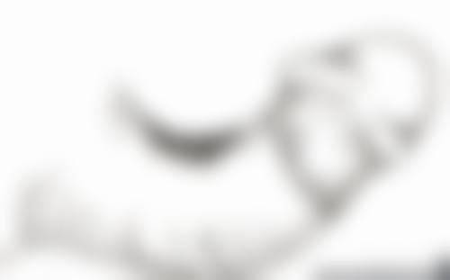 一、疤痕疙瘩的形成原因