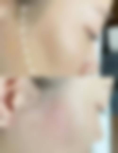 八、昆明赫柏医疗美容门诊部预约方式