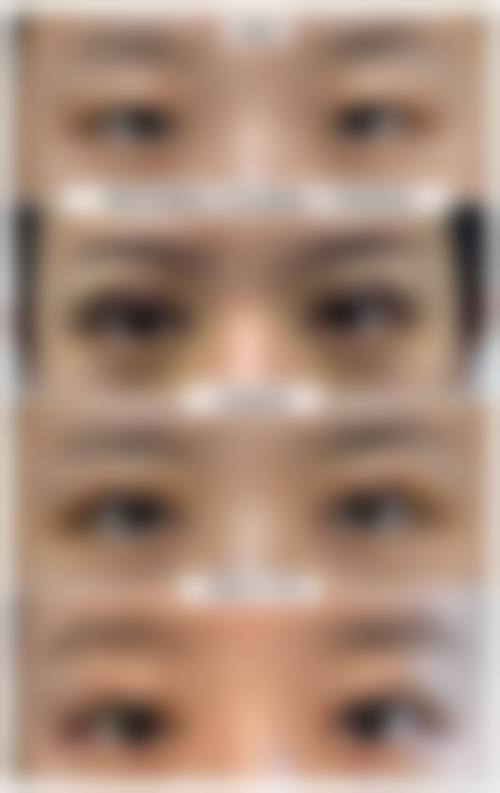 四、西安薇界医疗美容诊所特色项目