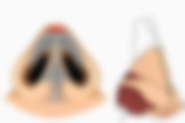 四、手术过程的轻松体验