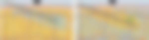 九、韩国丽婷Liting整形外科医院真实的患者评价