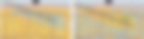 六、韩国丽婷Liting整形外科医院价格表