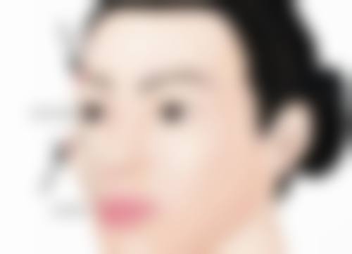 四、割完双眼皮怀孕相关的常见疑问解答