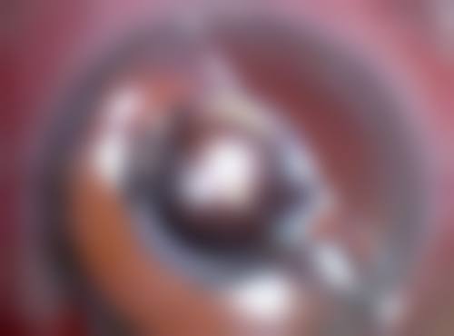 一、了解疤痕：去掉脸上伤疤的基础