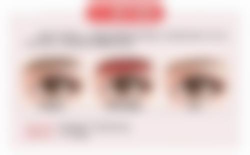 三、治疗须知：去掉脸上伤疤的注意事项