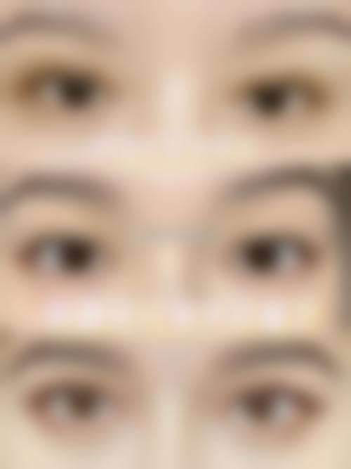 二、兴义市纤佳医疗美容诊所怎么样？